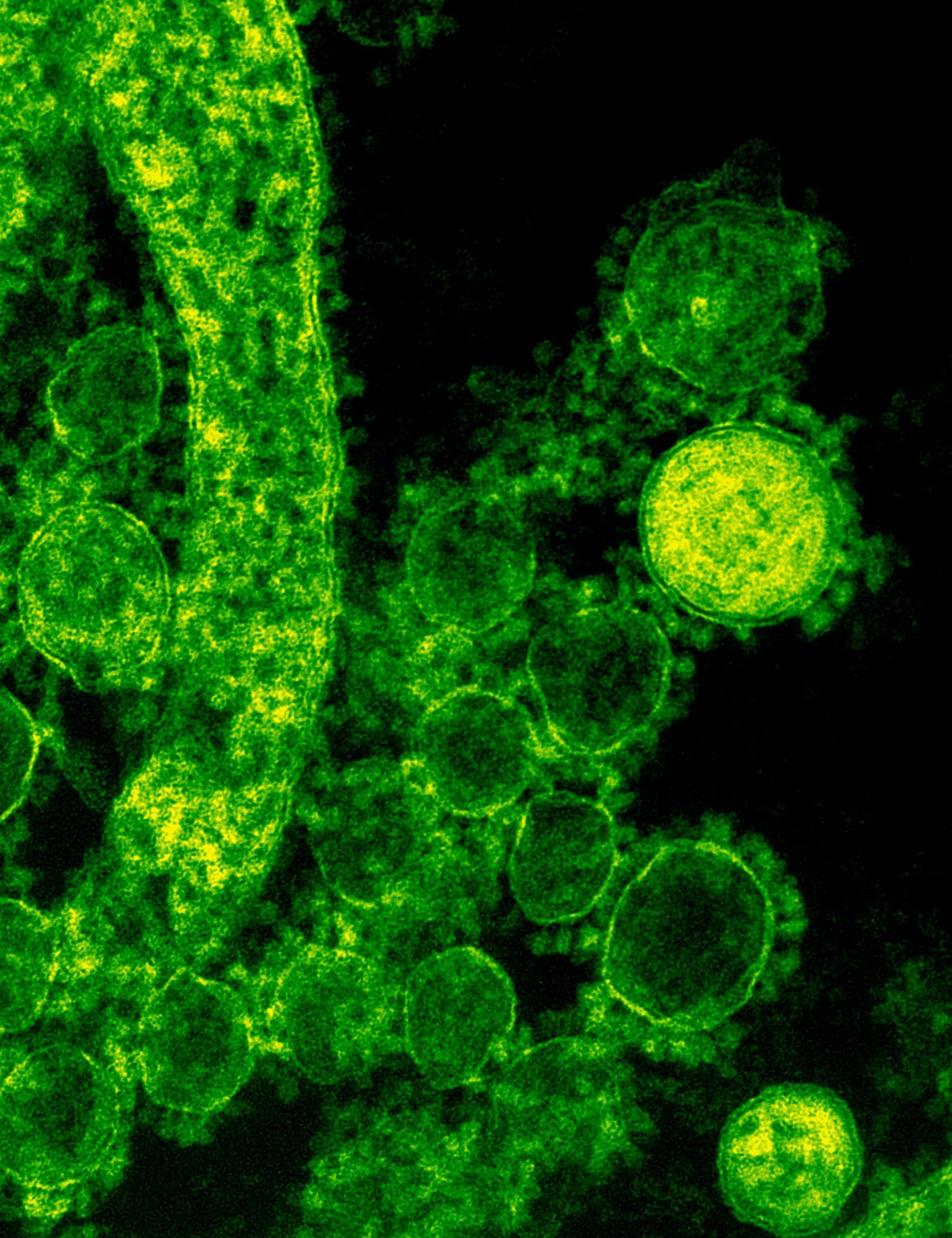 How Your Business Can Survive The Coronavirus Crisis Friend & Grant Accountants